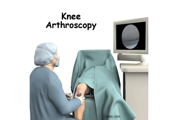 Arthroscopic Surgery